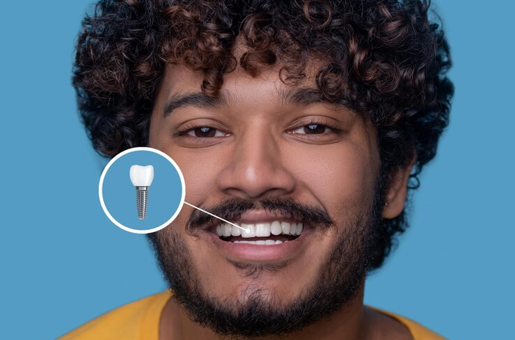 Implant-Supported Pr